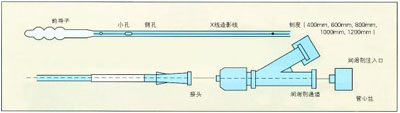 营养导管1.jpg